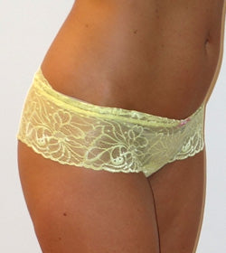 Kayser Delightfuls Stretch Lace Brazilian Bikini Bright
