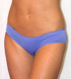 Sienna Smooth Stretch Boyleg Bikini Brief