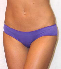 Sienna Smooth Stretch Boyleg Bikini Brief