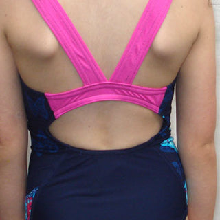 Zoggs Clovelly Speedback Girls' Swimsuit
